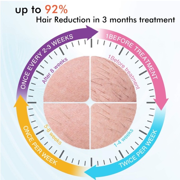 IMENE Permanent Hair Removal Machine - Picture 6 of 10